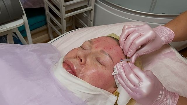 Инъекции красоты. Косметология. Ботокс, как дополнительный штрих к совершенству.