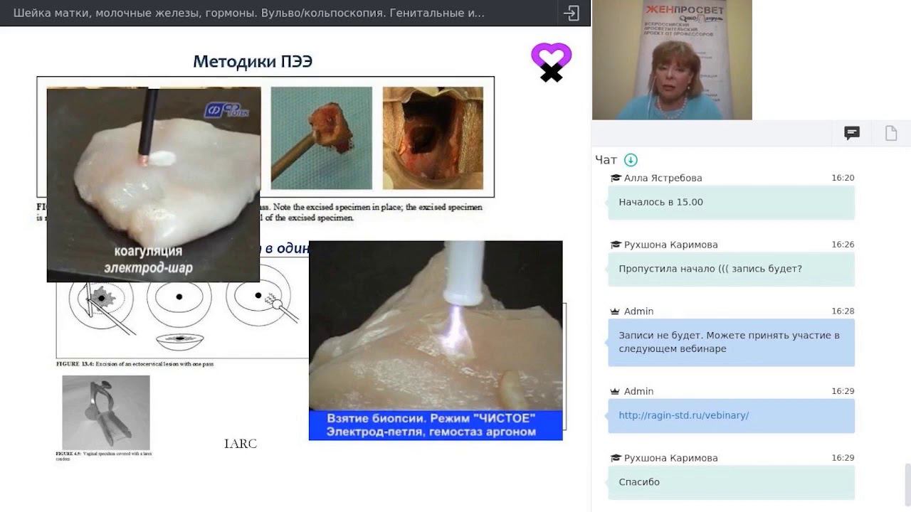 Шейка матки, инфекции, гормоны. Вульво/кольпоскопия. Практические вопросы смотреть онлайн