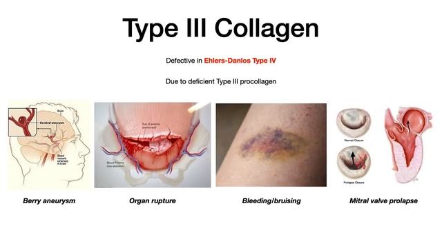 Types of Collagen смотреть онлайн