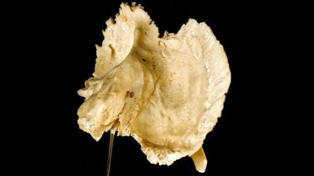 Височная кость (os temporale) | Анатомия человека [2019]✅ смотреть онлайн