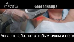 Фотоэпиляция в салоне Красотка