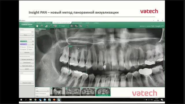 Рентгенодиагностика в стоматологии  Cовременные технологии от Vatech