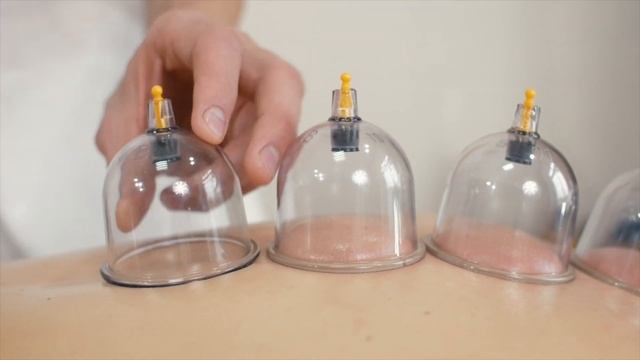 Баночный массаж смотреть онлайн