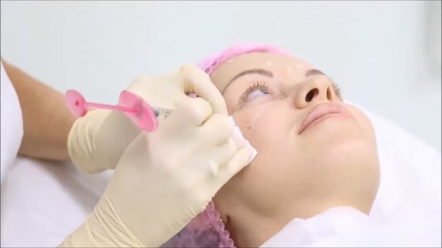 БОТОКС | ДИСПОРТ | РЕЛАТОКС смотреть онлайн