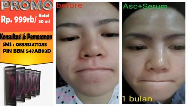 Jual Biogreen Bio SC Serum Cerahkan Kulit Samarkan Flek Original Murah Asli Wonogiri 083831471283 смотреть онлайн