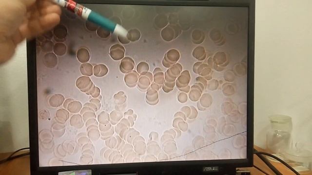 Что можно увидеть под микроскопом? Увеличение 1800 раз! Надо ли делать очистку организма?