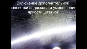 Доработка эндоскопа установкой дополнительного светодиода