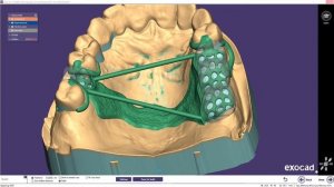 EXOCAD PartialCad Прямая трансляция из Дискорда. Моделировка бюгельных каркасов под печать.