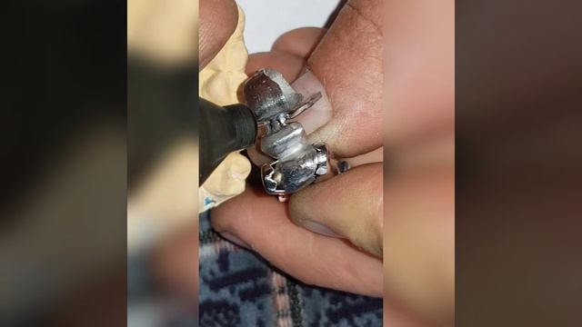 Сваривание зубного моста микросваркой МИСА-200 смотреть онлайн