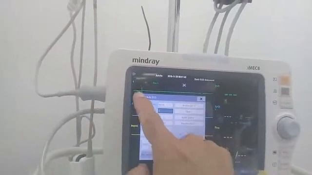 Manejo Basico Monitor Signos Vitales Mindray iMEC PARTE 1 смотреть онлайн