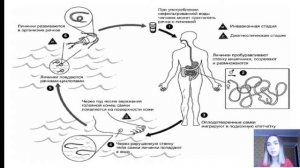 МЕДИЦИСКАЯ ПАРАЗИТОЛОГИЯ | Урок 8. Ришта.