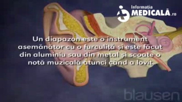 Testul Auditiv