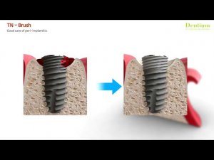 TN Brush animation. Dentium.