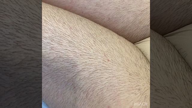 Шугаринг ноги полностью до и после смотреть онлайн