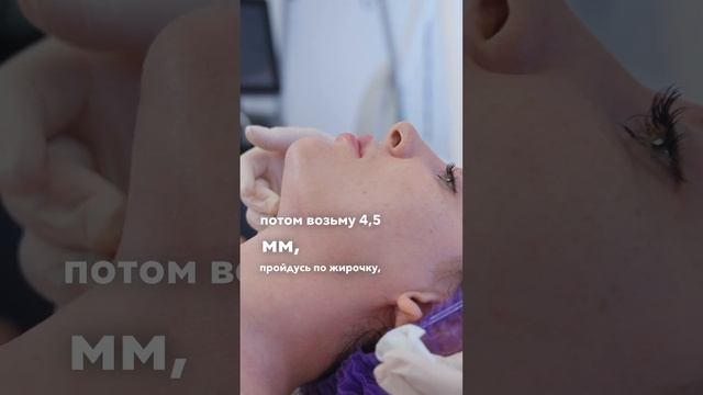 смас лифтинг ультраформер