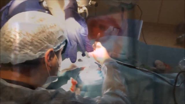 Cochlear Implantation / Кохлеарная имплантация (Digisonic SP - Neurelec)