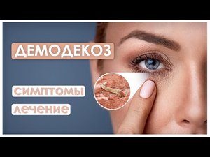 ДЕМОДЕКОЗ ВЕК / демодекозный блефарит / как избавиться