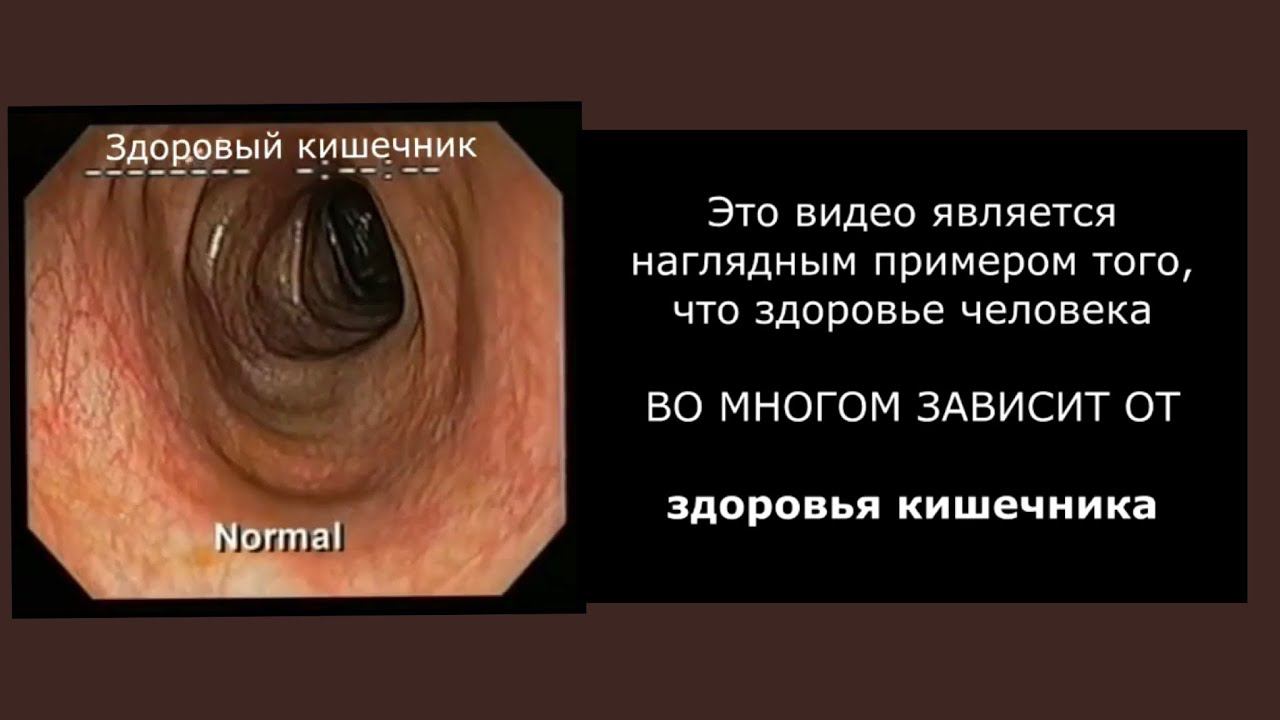 ЗДОРОВЫЙ И БОЛЬНОЙ КИШЕЧНИК