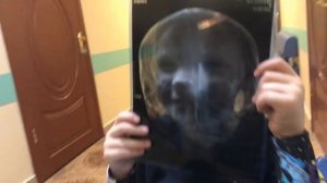 ВЛОГ_ Даня упал с гираскутера  (2019 год) перезалив