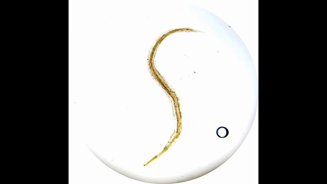 Острица Человеческая (Enterobius Vermicularis) Морфология, Жизненный Цикл, Диагностика, Профилактик