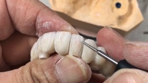 Creating Individual-Looking Teeth On A Full-Arch Bridge | Dental Lab Learning