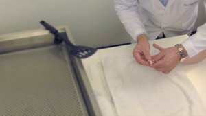 УСТАНОВКА ФИКСАТОРА ДЛЯ ФАЛАНГИ ПАЛЬЦЕВ РУКИ