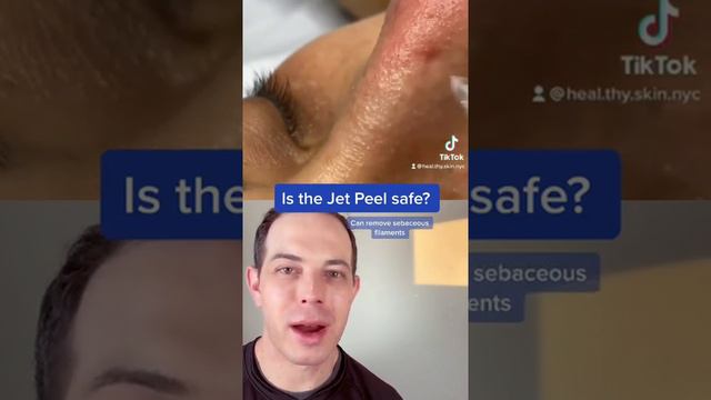 Crazy way to remove blackheads? Jet Peel Demo | 208SkinDoc