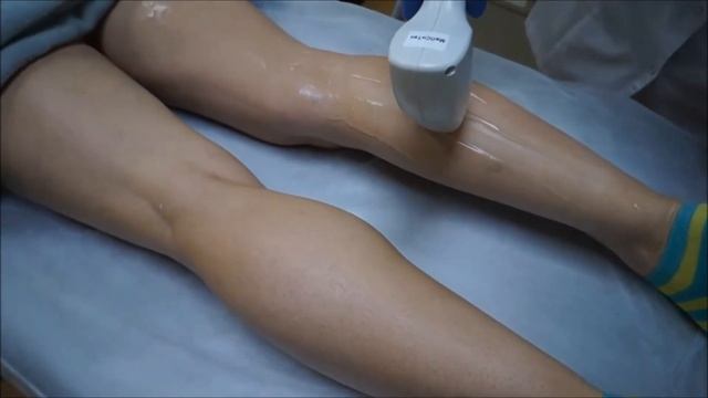 Парадиз. Лазерная эпиляция смотреть онлайн