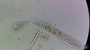 Инфузория Spirostomum