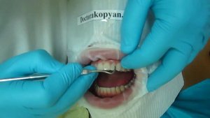 Люминиры установка. Часть 3