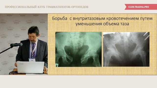 Прямая трансляция | Профессиональный клуб травматологов-ортопедов