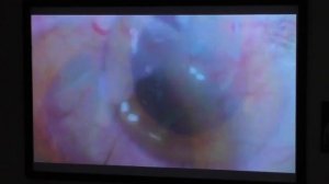 Фако Озурдекс