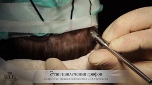 Как отрастить брови? Пересадить их в Real Trans Hair!
