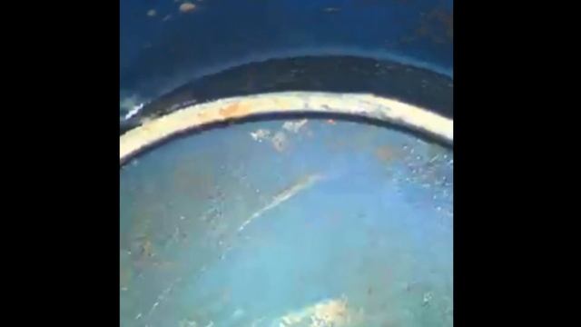 2020-06-12 Бессимптомный резорциненый зуб. смотреть онлайн