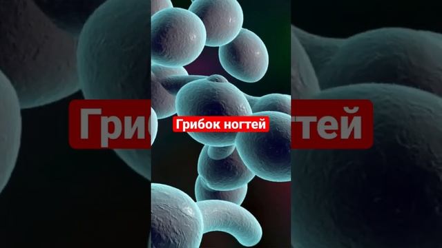 Почему белые пятна на ногтях?