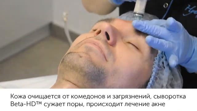 HydraFacial MD — Мужской уход смотреть онлайн