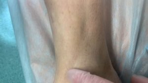 "Симптом канавки"