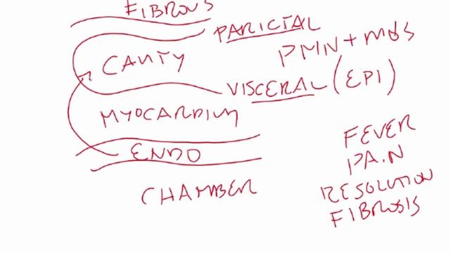 USMLE RX - 2.Кардиология - 3.Патология - 2.Острый перикардит