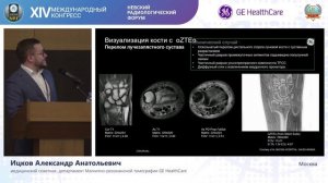 Симпозиум «Кость как орган: мультимодальный подход» при поддержке компании GE HealthCare