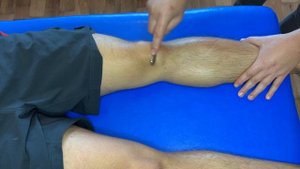 Связка надколенника. Инструментальная мобилизация при помощи NordBlade 3.0. ИММТ Павел Коломиец.