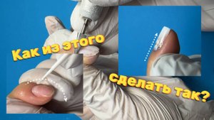 Ногти горбатые и клюют?