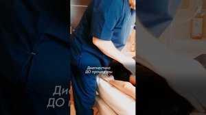 Зрение улучшилось сразу после Акупрессуры подзатылочных мышц! АКУПРЕССУРА - Россия. Отзыв #зрение