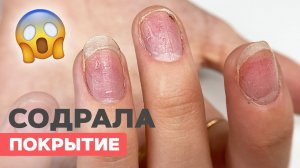 Что делать? Оторвала гель-лак | Тонкие ногти и наращивание