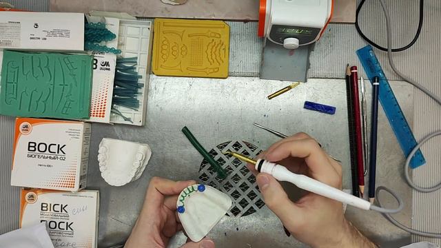 Моделирование шинирующего бюгельного протеза на н/ч.