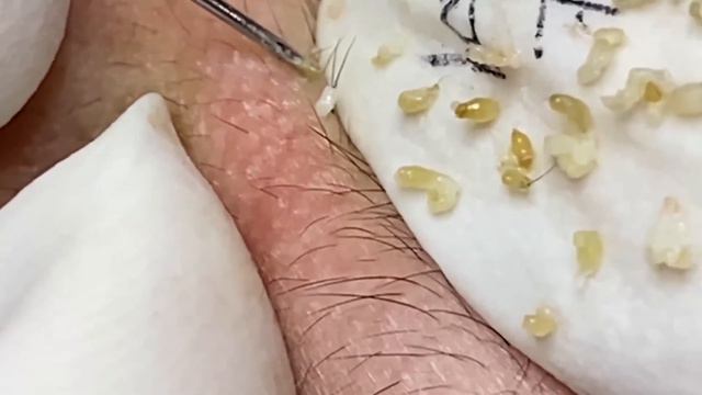 Enjoy Every Day With The Best Video Loan Nguyen Spa Official 2649 смотреть онлайн