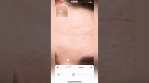 КАК УБРАТЬ МОРЩИНЫ НА ФОТО. Приложение Meitu