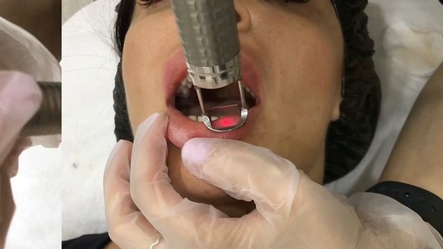 SMOOTH LIPS: КРАСИВЫЕ ГУБЫ БЕЗ ИНЪЕКЦИЙ смотреть онлайн