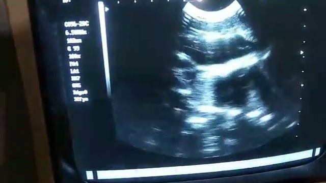 Биение сердца у плода козы смотреть онлайн