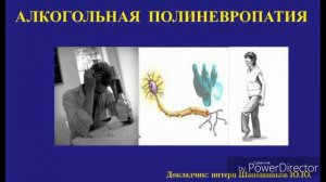 Polinevropatiya.Полиневропатия