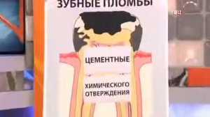 Виды зубных пломб. Автор видео ТВЦ